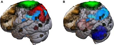 It Is Time to Study Overlapping Molecular and Circuit Pathophysiologies in Alzheimer’s and Lewy Body Disease Spectra